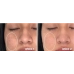 Сыворотка с 20% ниацинамида 20 мл / Clinical niacinamide 20% treatment